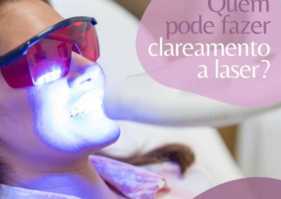 Clareamento a laser